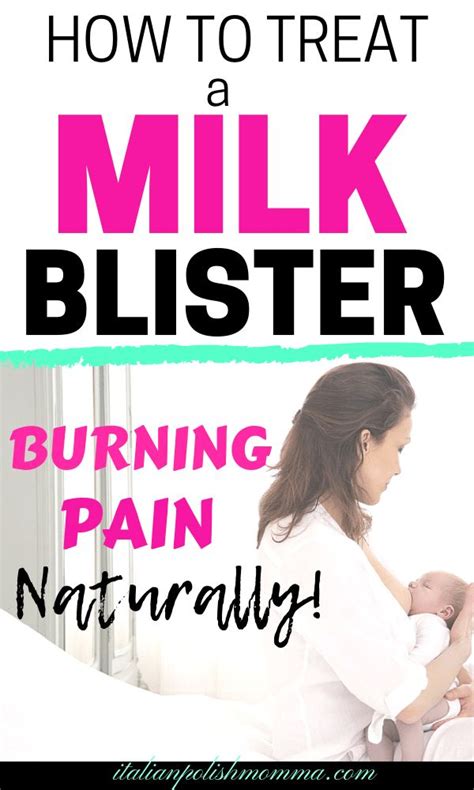 7 Effective Ways to Treat Milk Blisters and Thrush Naturally | Milk blister, Breastfeeding ...