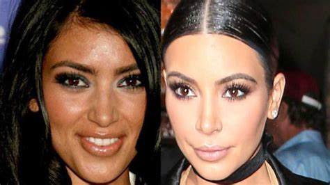 Kim Kardashian's plastic surgery timeline - before and after surgery | Hair B… | Kardashian ...