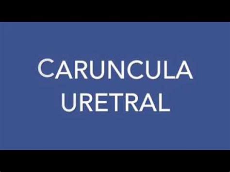 CARÚNCULA URETRAL - YouTube