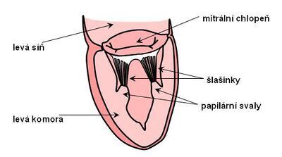 Papillary muscle - WikiLectures