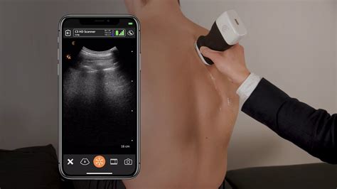 Lung Ultrasound Scanning - YouTube