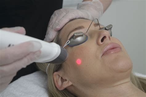 Laser Genesis | Beauty Emporium