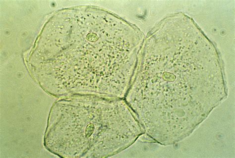 Human Cheek Cells Under A Microscope