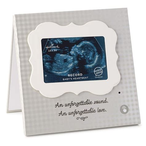 Recordable Sonogram Picture Frame | Sonogram picture frame, Sonogram pictures, Baby picture frames