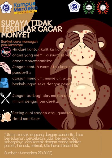 Waspada Cacar Monyet!!! – STIKES BAKTI UTAMA PATI