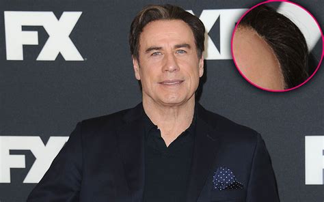 Sticky Situation! John Travolta Has Odd Gunk Along His Hairline — Is He Wearing A Wig? | Star ...