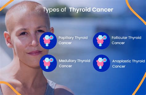 Thyroid Cancer: Everything You Need To Know | ACTC