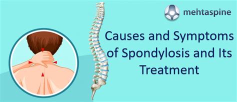 Causes and Symptoms of Spondylosis and Its Treatment | MehtaSpine UK