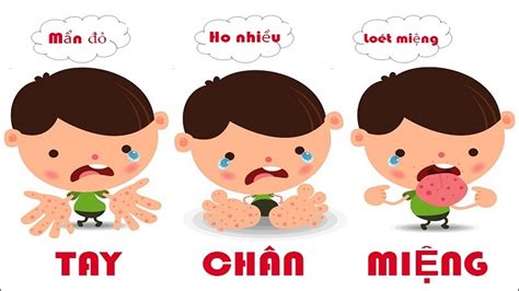 Tay chân miệng: Nguyên nhân, triệu chứng và cách điều trị - Bệnh viện ...