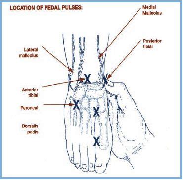 bandages for pressure ulcers | ... apbi 0 8 1 2 treat as venous ulcer 0 6 0 8 treat as mixed ...