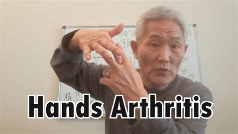 Hand Arthritis - YouTube