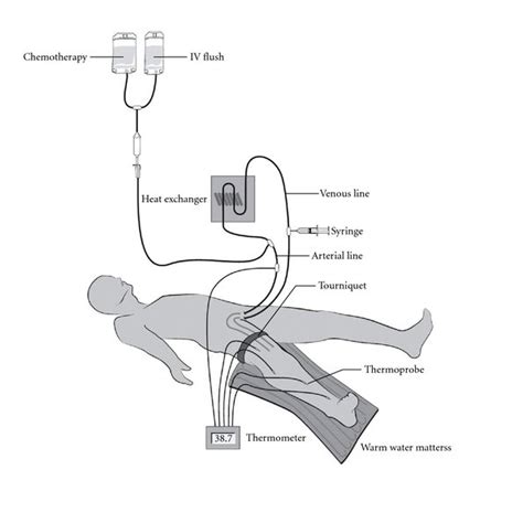 Schematic illustration of the circuit used for isolated infusion of a... | Download Scientific ...