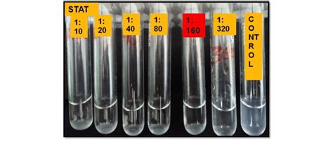 Standard Tube Agglutination Test (STAT): Note the mat formation upto... | Download Scientific ...