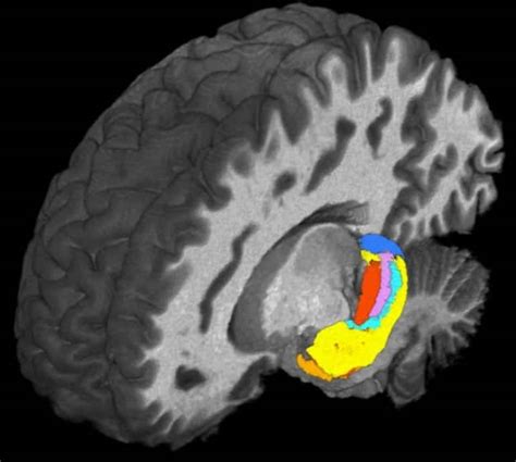 Ultra-High Field MRI Detects Differences in Brain's Hippocampus - Neuroscience News