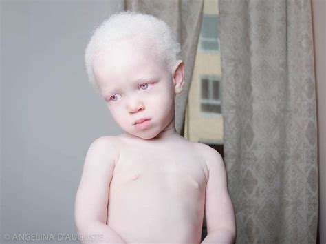 58 Albino People Who’ll Mesmerize You With Their Otherworldly Beauty ...