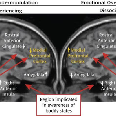 (PDF) Dissociation, Dissociative Disorders, and PTSD