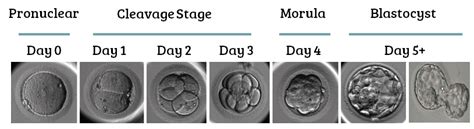 Complete Guide to Embryo Grading and Success Rates | Remembryo