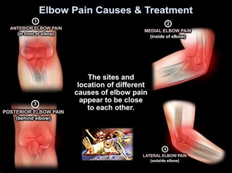 Elbow Pain Causes & Treatment - Everything You Need To Know - Dr. Nabil ...