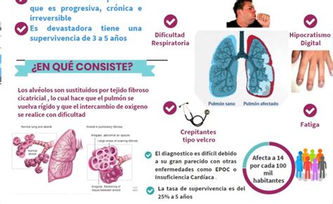 Conozca Las Causas Y Sintomas De La Fibrosis Pulmonar – Otosection