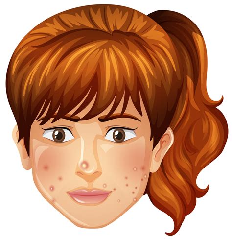 A Girl with Pimples Problem 298104 Vector Art at Vecteezy