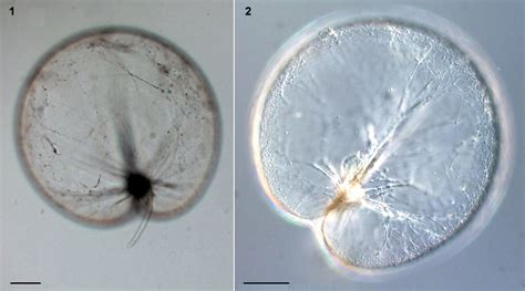 Noctiluca scintillans