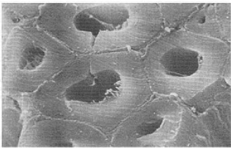 2 Part of a fiber bundle of jute as seen in transverse view under the... | Download Scientific ...