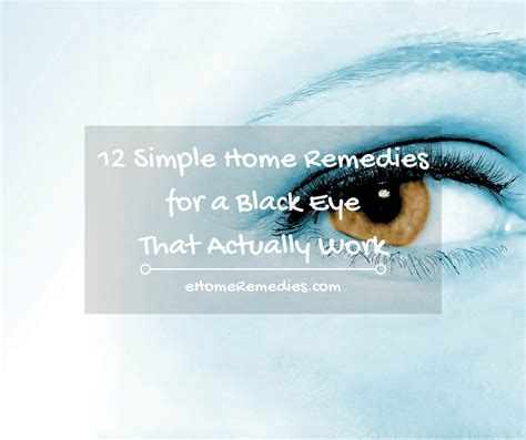 12 Simple Home Remedies For A Black Eye