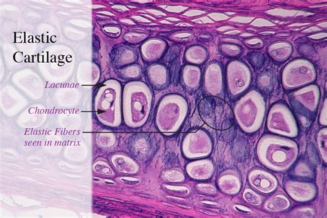 Elastic cartilage | Basic anatomy and physiology, Tissue types, Keep ...