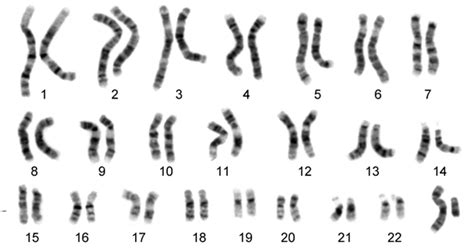 Pengertian Struktur dan Fungsi Kromosom Pada Manusia - Generasi Biologi