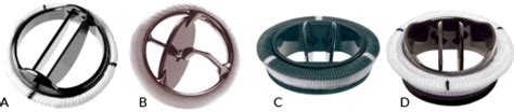 The four types of mechanical aortic valves used. The St | Open-i