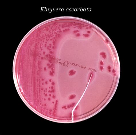 Public Domain Picture | After 24 hours, this inoculated MacConkey agar culture plate cultivated ...