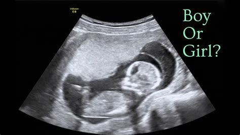 Gender Reveal & How I Knew Before the Ultrasound - YouTube