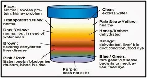 Passing dark colored urine (Urinary Bladder cancer) | Mind Map