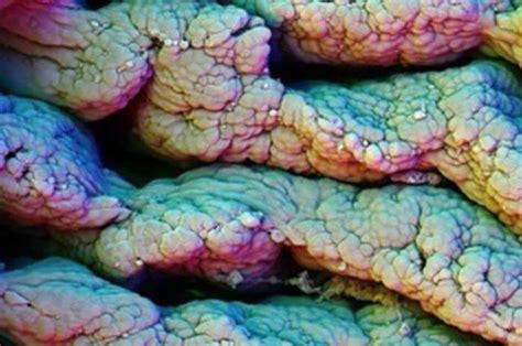 The Human Body Under a Microscope (18 pics) - Izismile.com