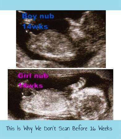 16 Week Ultrasound Boy