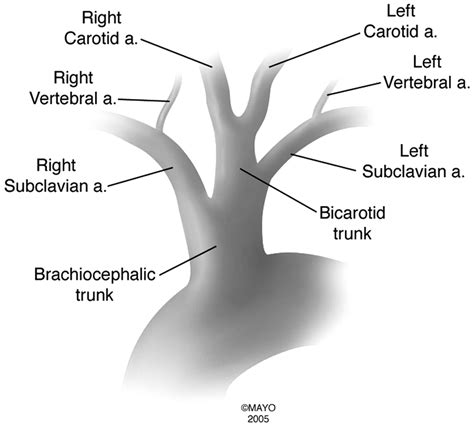 Arteries Of The Aortic Arch