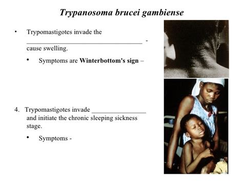 Leishmania And Trypanosoma