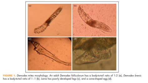 Demodex mites: Large and neglected group of wild animals — EA Forum