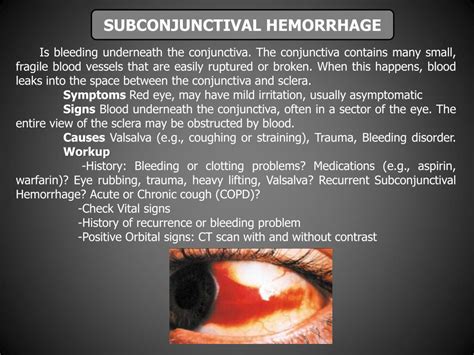 PPT - OCULAR TRAUMA. DIAGNOSIS AND TREATMENT. PowerPoint Presentation, free download - ID:3888279