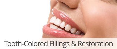 Tooth-Colored Fillings - Dr. Moshe DDS - Encino CA