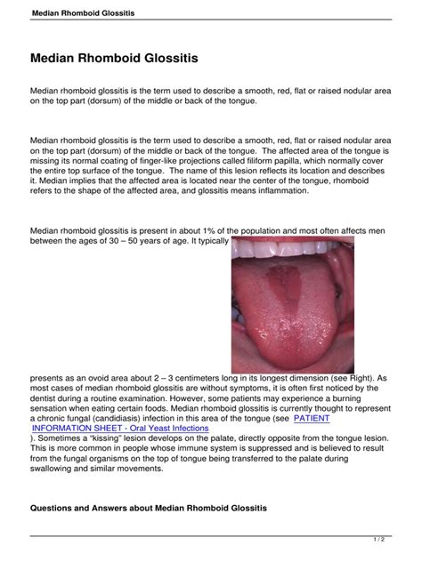 Median Rhomboid Glossitis | PDF | Tongue | Medical Diagnosis