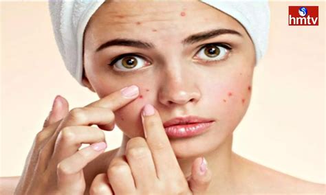 Skin Allergies: చర్మ వ్యాధులకు కారణాలు ఏంటి.. లక్షణాలు, నివారణలు ...