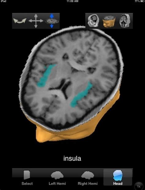 Brain Posts: The Brain Insula: Function and Disease