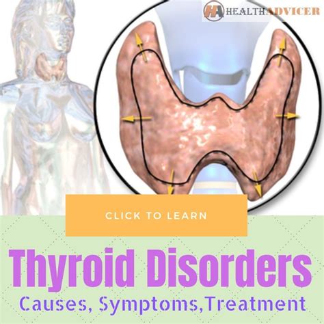 Thyroid Disorders: Causes, Picture, Symptoms, Treatment