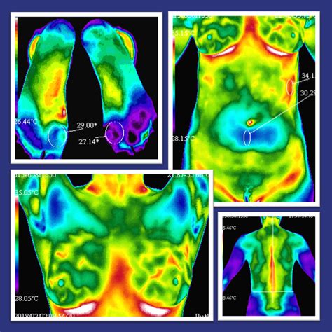 Thermography Services - Thermography for Health New York