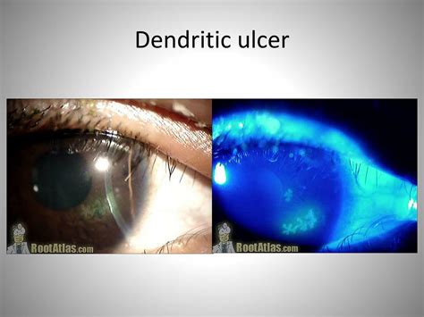 PPT - Interactive Ophthalmology Quiz PowerPoint Presentation, free download - ID:6686714