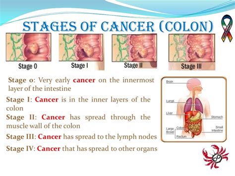 Cancer