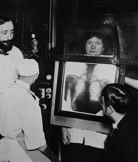 MD ☆☆☆ Radioscopie pulmonaire. | Medical history, Medical photography, Radiography