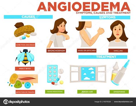 Angioedema Symptom Causes Treatment Disease Vector Poster Reason Sickness Food Stock Vector ...