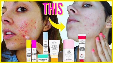 DRUNK ELEPHANT SAVED MY SKIN?! Drunk Elephant Skincare for Acne - YouTube